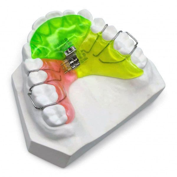 Palate Expander