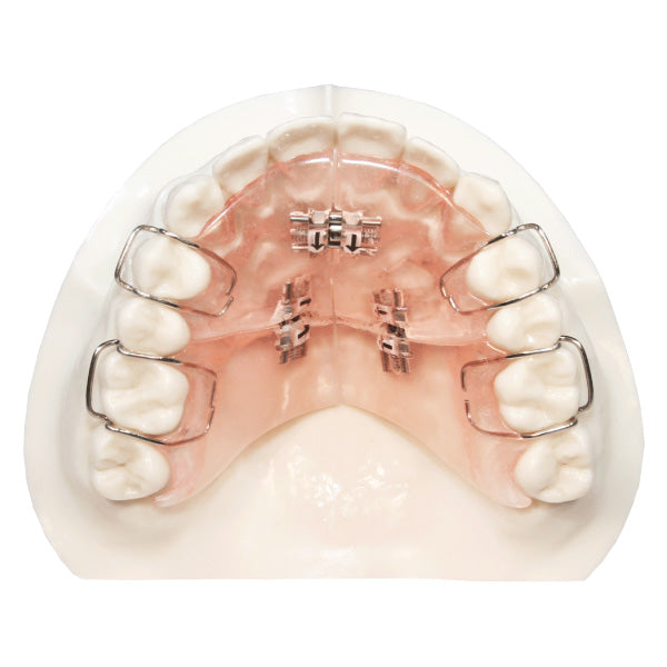 Palate Expander