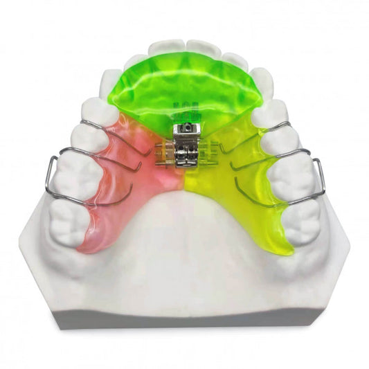Palate Expander