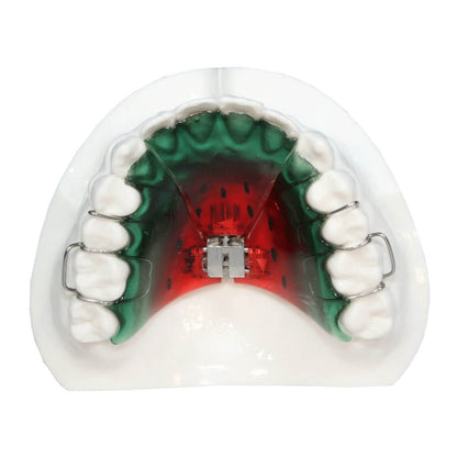 Palate Expander
